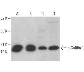 p-Cofilin 1 Antibody (H-2) - Western Blotting - Image 376407 