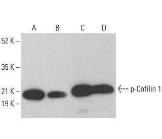 western blotting image from recommended p-Cofilin 1 (E-5) monoclonal antibody replacement. Image 376469