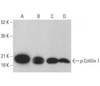 western blotting image from recommended p-Cofilin 1 (F-11) monoclonal antibody replacement. Image 376408