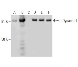p-Dynamin I Antibody (F-11) - Western Blotting - Image 299350 