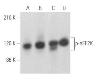 p-eEF2K Antibody (C-4) - Western Blotting - Image 355496 
