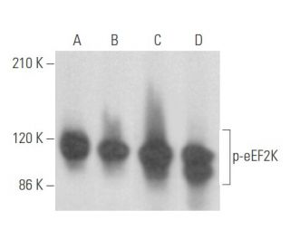 p-eEF2K Antibody (H-2) - Western Blotting - Image 355494 