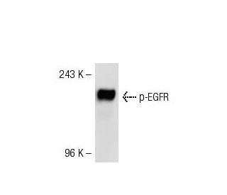 p-EGFR Antibody (6D373) - Western Blotting - Image 53283
