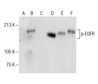 western blotting image from recommended p-EGFR (F-3) monoclonal antibody replacement. Image 287660