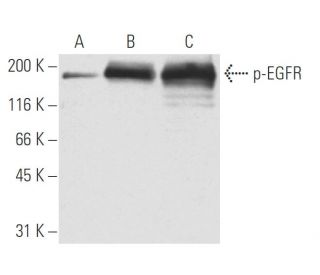 western blotting image from recommended p-EGFR (9H2) monoclonal antibody replacement. Image 62887
