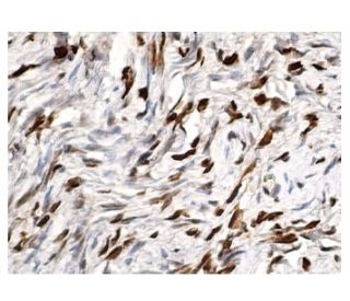 immunohistochemistry image from recommended p-Elk-1 (B-4) monoclonal antibody replacement. Image 156584
