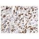 immunohistochemistry image from recommended p-Elk-1 (B-4) monoclonal antibody replacement. Image 156584