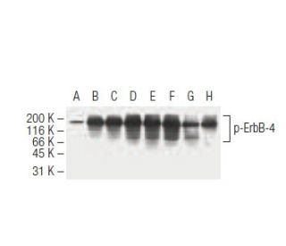 p-ErbB4/HER4 Antibody (4C6) - Western Blotting - Image 62924 