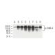 p-ErbB4/HER4 Antibody (4C6) - Western Blotting - Image 62924 