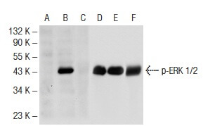 E.R.Kページ p-ERK 1/2 Antibody (12D4) | SCBT - Santa Cruz Biotechnology