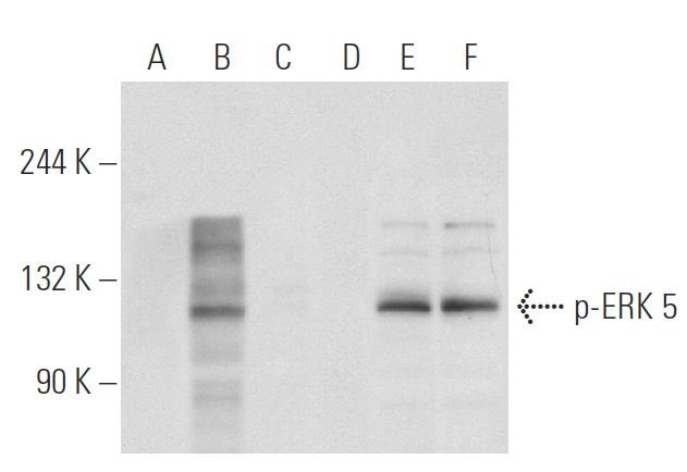 p-ERK 5 Antibody (1.T218/Y220) | SCBT - Santa Cruz Biotechnology