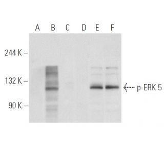 western blotting image from recommended p-ERK 5 (1.T218/Y220) monoclonal antibody replacement. Image 93565