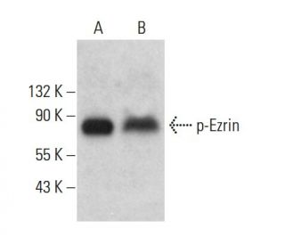 p-Ezrin Antibody (G-7) - Western Blotting - Image 376048 