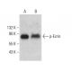p-Ezrin Antibody (G-7) - Western Blotting - Image 376048 