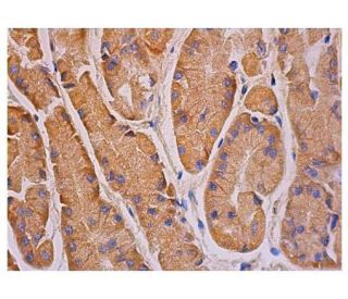 immunohistochemistry image from recommended p-FAK (A-12) monoclonal antibody replacement. Image 348943