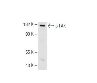 western blotting image from recommended p-FAK (2D11) monoclonal antibody replacement. Image 62523