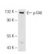Este anticuerpo policlonal ha dejado de fabricarse. Consulta nuestro anticuerpo monoclonal recomendado <a href="p-fak-antibody-2d11">p-FAK (2D11)</a> (se muestran datos de muestra). western blotting image from recommended p-FAK (2D11) monoclonal antibody replacement. Image 62523