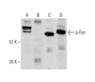 western blotting image from recommended p-Fyn (D-1) monoclonal antibody replacement. Image 289917