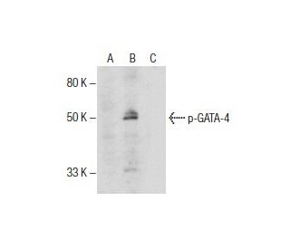 p-GATA4 Antibody (H-4) - Western Blotting - Image 285819
