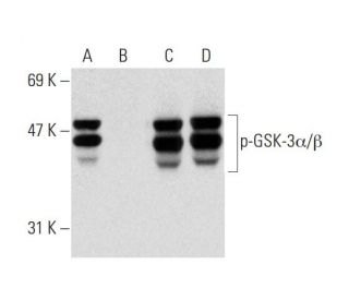 western blotting image from recommended p-GSK3 alpha/beta (6D3) monoclonal antibody replacement. Image 138422