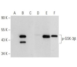 p-GSK3 beta Antibody (3A8) - Western Blotting - Image 82596 