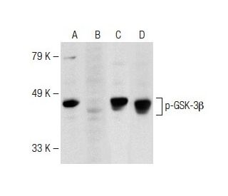 P-GSK3 Beta抗体 (F-2) | SCBT - Santa Cruz Biotechnology