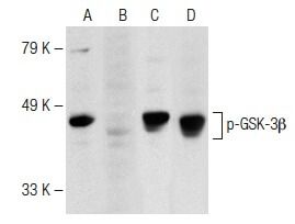 P-GSK3 Beta抗体 (F-2) | SCBT - Santa Cruz Biotechnology