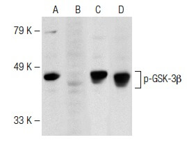p-gsk-3beta-antibody-ser-9-