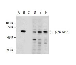 p-hnRNP K Antibody (H-5) - Western Blotting - Image 146927