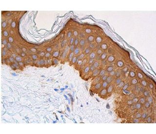 p-HSP 27 Antibody (D-3) - Immunohistochemistry - Image 356368 