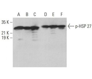 western blotting image from recommended p-HSP 27 (B-3) monoclonal antibody replacement. Image 377112