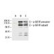 p-IGF-1 Receptor/IGF1R Antibody (2B9) - Western Blotting - Image 62927