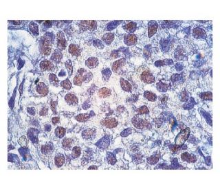 immunohistochemistry image from recommended p-NFKBIA/IkB alpha (B-9) monoclonal antibody replacement. Image 160127