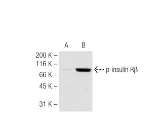 p-INSR/Insulin Receptor &beta; Antibody (10C3) - Western Blotting - Image 62929