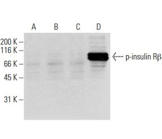 p-INSR/Insulin Receptor &beta; Antibody (21G12) - Western Blotting - Image 62930