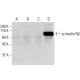 p-INSR/Insulin Receptor β Antibody (21G12) - Western Blotting - Image 62930