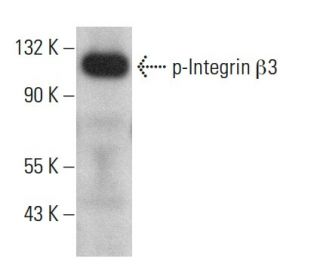 p-Integrin &beta;3/ITGB3/CD61 Antibody (pY759.7A) - Western Blotting - Image 380512