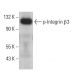 p-Integrin β3/ITGB3/CD61 Antibody (pY759.7A) - Western Blotting - Image 380512