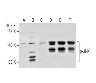 p-JNK Antibody (14.Thr 183/Tyr 185) | SCBT - Santa Cruz p-JNK Antibody (14.Thr 183/Tyr 185) | SCBT - Santa Cruz