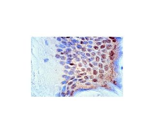 p-JNK Antibody (G-7) | SCBT - Santa Cruz Biotechnology