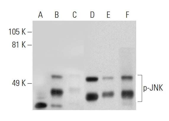 p-JNK Antibody (G-7) | SCBT - Santa Cruz Biotechnology