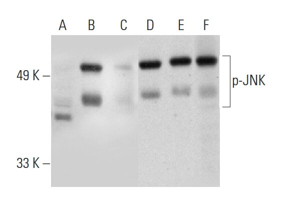 jnk 様 p-JNK Antibody (G-7) | SCBT - Santa Cruz Biotechnology