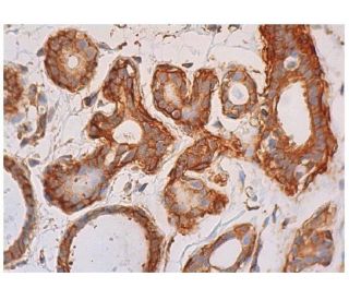 immunohistochemistry image from recommended p-JNK (G-7) monoclonal antibody replacement. Image 348288