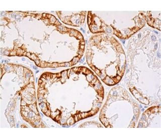 p-KV4.2 Antibody (A-5) - Western Blotting - Image 384639 