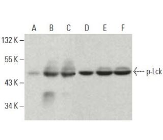 p-Lck Antibody (pY505.4) - Western Blotting - Image 396681 