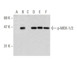 western blotting image from recommended p-MEK-1/2 (7E10) monoclonal antibody replacement. Image 136017