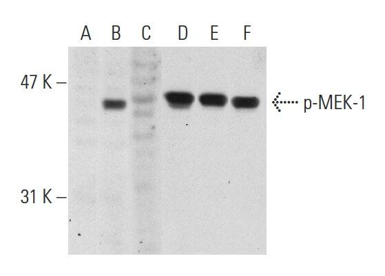 パンダp　メクエレク・エンジニアリング社　メグライトMEK-ELEK LQ-MD Funai Mek Dased Solvent Ink - Buy Themal Inkjet Ink