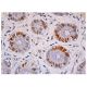 immunohistochemistry image from recommended p-Met (F-5) monoclonal antibody replacement. Image 349121