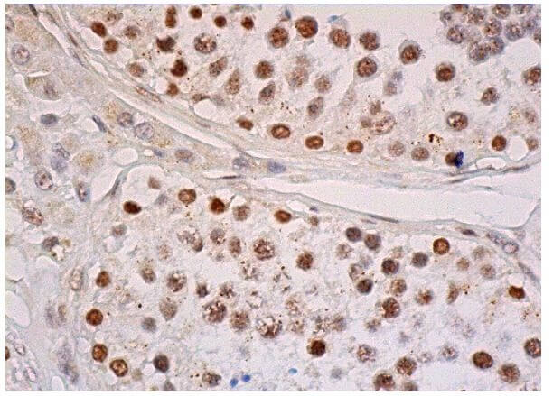 フルドド様 adidas ZX 8000 - Semi Blue Burst - IE2964 | OUTBACK Sylt