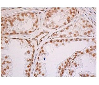 p-mTOR Antibody (59.Ser 2448) | SCBT - Santa Cruz Biotechnology
